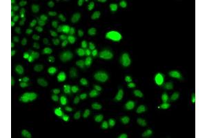 Immunofluorescence analysis of  cells using PIP4K2A antibody (ABIN6130624, ABIN6145673, ABIN6145674 and ABIN6223324).
