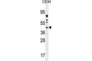 Western blot analysis in CEM cell line lysates (35ug/lane) using DNAJC22 Antibody (C-term). (DNAJC22 anticorps  (C-Term))