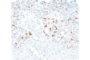 Immunohistochemistry (IHC) image for anti-Ubiquitin-Like, Containing PHD and RING Finger Domains, 1 (UHRF1) (AA 1-50) antibody (ABIN7795824)