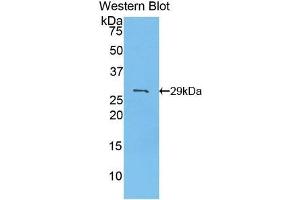 Detection of Recombinant PDK2, Mouse using Polyclonal Antibody to Pyruvate Dehydrogenase Kinase Isozyme 2 (PDK2) (PDK2 anticorps  (AA 155-379))