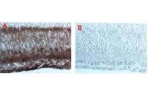 anti-Disabled Homolog 1 (Drosophila) (DAB1) (AA 400-555) antibody
