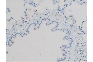 ABIN6256297 and ABIN6267410 at 1/200 staining Rat lung tissue sections by IHC-P. (Connexin 43/GJA1 anticorps  (pSer368))