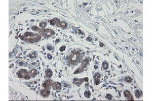 Immunohistochemical staining of paraffin-embedded Human breast tissue using anti-VBP1 mouse monoclonal antibody. (VBP1 anticorps)