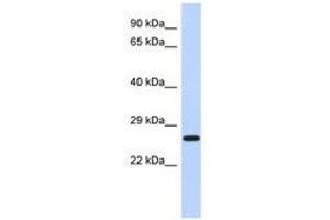 Image no. 1 for anti-EF-Hand Domain Family, Member D2 (EFHD2) (N-Term) antibody (ABIN6741472) (EFHD2 anticorps  (N-Term))
