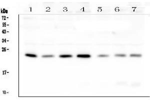Western blot analysis of RAB11B using anti-RAB11B antibody (ABIN6719364). (RAB11B anticorps)