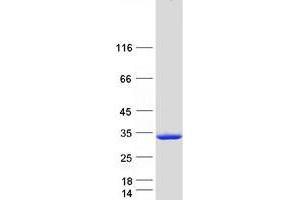 Validation with Western Blot