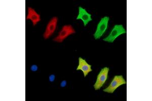 ABIN7096645 and ABIN7100710 staining HepG2 cells by IF/ICC.