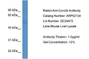 WB Suggested Anti-Coro2b  Antibody Titration: 0. (CORO2B anticorps  (C-Term))