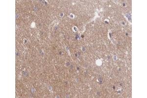 ABIN6266482 at 1/200 staining human brain tissue sections by IHC-P.