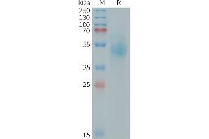 Human (544-643) Protein, mFc Tag on SDS-PAGE under reducing condition.