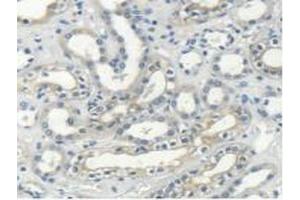 Detection of MYH14 in Human Kidney Tissue using Polyclonal Antibody to Myosin Heavy Chain 14, Non Muscle (MYH14) (Myosin anticorps  (AA 1069-1331))