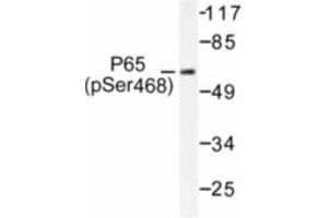 Image no. 1 for anti-Nuclear Factor-kB p65 (NFkBP65) (pSer468) antibody (ABIN318083) (NF-kB p65 anticorps  (pSer468))