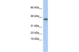 WB Suggested Anti-GLYAT Antibody Titration:  0. (GLYAT anticorps  (N-Term))