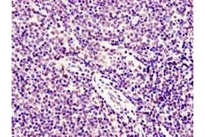 Immunohistochemistry of paraffin-embedded human lymph node tissue using ABIN7171071 at dilution of 1:100 (SMARCD1 anticorps  (AA 7-124))