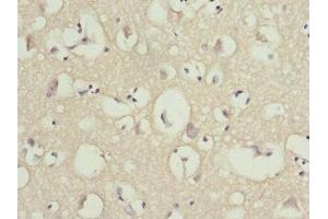 Immunohistochemistry of paraffin-embedded human brain tissue using ABIN7162207 at dilution of 1:100 (OMG anticorps  (AA 190-420))