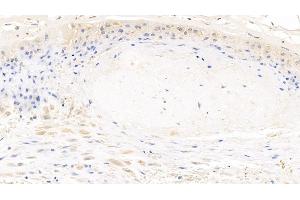 Detection of MYH9 in Human Placenta Tissue using Polyclonal Antibody to Myosin Heavy Chain 9, Non Muscle (MYH9) (Myosin 9 anticorps  (AA 1740-1960))