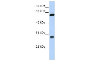 ACD antibody used at 1 ug/ml to detect target protein.