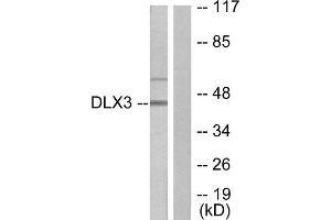 Western Blotting (WB) image for anti-Distal-Less Homeobox 3 (DLX3) (Internal Region) antibody (ABIN1848996) (DLX3 anticorps  (Internal Region))