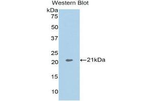 Western Blotting (WB) image for anti-Actin Related Protein 2/3 Complex, Subunit 4, 20kDa (ARPC4) (AA 3-163) antibody (ABIN3202609) (ARPC4 anticorps  (AA 3-163))