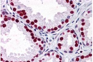 Human Prostate: Formalin-Fixed, Paraffin-Embedded (FFPE) (SMAD6 anticorps  (AA 285-385))