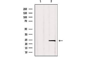Western blot analysis of extracts from Rat lung, using RGS2 Antibody.