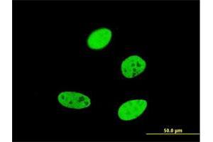 Immunofluorescence of monoclonal antibody to FOXA2 on HeLa cell. (FOXA2 anticorps  (AA 363-457))