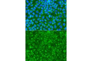 Immunofluorescence analysis of A549 cell using STRN antibody. (Striatin anticorps)