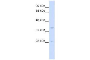 Western Blotting (WB) image for anti-Indolethylamine N-Methyltransferase (INMT) antibody (ABIN2459224)