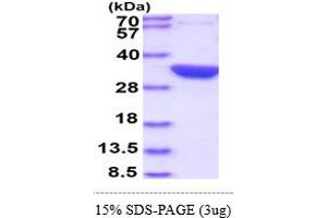 SDS-PAGE (SDS) image for Glutaminase A L-Glutamine Amidohydrolase (GLS-A1) (AA 1-310) protein (His tag) (ABIN667448) (glsA1 Protein (AA 1-310) (His tag))