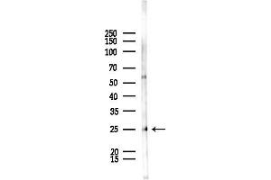 Western blot analysis of lysates from Rat lung, using RALB Antibody at 1/1000 dilution.