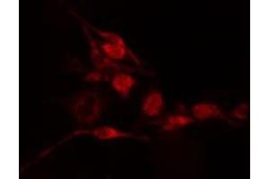 ABIN6275522 staining  Hela cells by IF/ICC. (Septin 2 anticorps  (Internal Region))