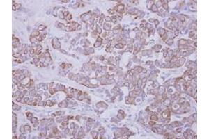 Image no. 1 for anti-Glycosyltransferase-Like Domain Containing 1 (GTDC1) (AA 1-204) antibody (ABIN1498561)