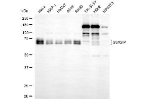 Western blotting analysis using SSX2IP antibody (ABIN7800977).