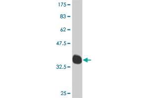 Western Blot detection against Immunogen (35. (MEOX1 anticorps  (AA 82-170))