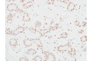 Immunohistochemistry (IHC) image for anti-Mediator Complex Subunit 12 (MED12) (AA 2127-2177) antibody (ABIN7453977)