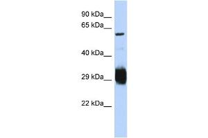 Host:  Rabbit  Target Name:  SETMAR  Sample Type:  Jurkat Whole Cell lysates  Antibody Dilution:  1. (SETMAR anticorps  (C-Term))