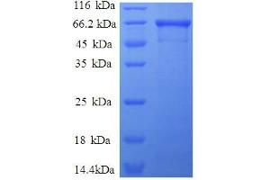 SDS-PAGE (SDS) image for Aldolase A, Fructose-Bisphosphate (ALDOA) (AA 2-364) protein (GST tag) (ABIN5712023) (ALDOA Protein (AA 2-364) (GST tag))