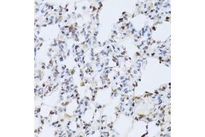 Immunohistochemistry of paraffin-embedded rat lung using MAPK3 Antibody.