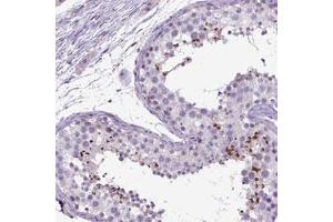 Immunohistochemical staining (Formalin-fixed paraffin-embedded sections) of human testis with NEK5 polyclonal antibody  shows strong cytoplasmic positivity in spermatozoa and spermatids. (NEK5 anticorps)
