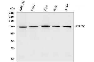 Western blot analysis of ATP11C using anti-ATP11C antibody (ABIN7602985).