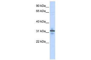 Western Blotting (WB) image for anti-Ribose 5-Phosphate Isomerase A (RPIA) antibody (ABIN2459906) (Ribose 5-Phosphate Isomerase A (RPIA) anticorps)