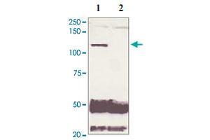 5 mg of the whole cell lysate derived from conditioned LNCaP were immunoprecipitated by 4 ug of Phospho-AR S210 polyclonal antibody (Cat # PAB12654, lane 1) or pre adsorbed by immunization peptide (lane 2) followed by AR polyclonal antibody  at 1 : 500. (Androgen Receptor anticorps  (N-Term))