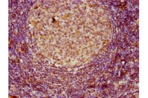 anti-CD3 epsilon (CD3E) (AA 23-207) antibody