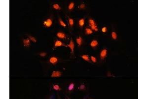Immunofluorescence analysis of U-2 OS cells using PHLPP1 Polyclonal Antibody at dilution of 1:100 (40x lens). (PHLPP1 anticorps)