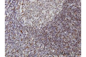 Immunoperoxidase of monoclonal antibody to IFI16 on formalin-fixed paraffin-embedded human tonsil.