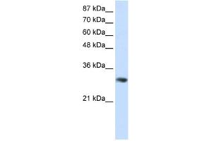 WB Suggested Anti-GNB2L1 Antibody Titration:  0.