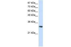 GNB2L1 antibody  (C-Term)