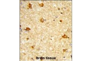 Formalin-fixed and paraffin-embedded human brain tissue reacted with DIRAS1 Antibody (Center), which was peroxidase-conjugated to the secondary antibody, followed by DAB staining.
