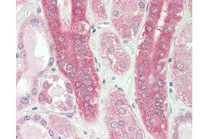 anti-Calpain 1 (CAPN1) (AA 468-481) antibody