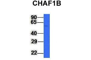 Host:  Rabbit  Target Name:  CHAF1B  Sample Type:  Jurkat  Antibody Dilution:  1. (CHAF1B anticorps  (N-Term))